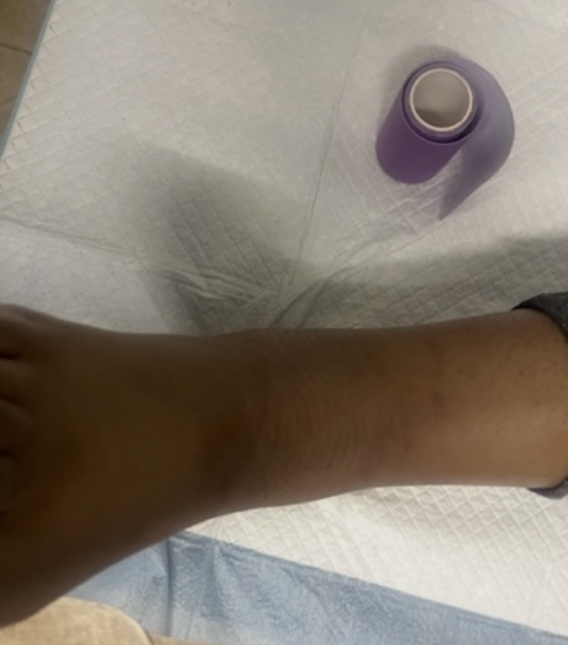 Case photo 13