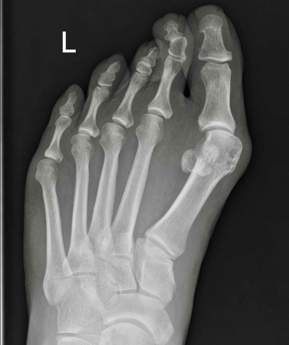 Case photo 4