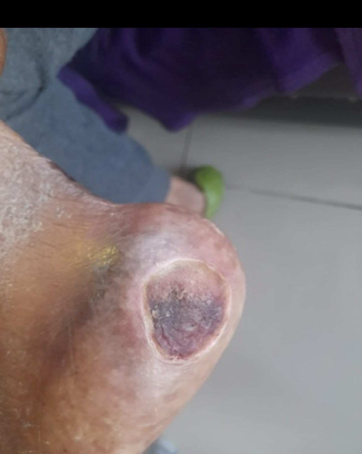Case photo 9